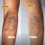 Ephemeral Semi-Permanent Tattoos - Ganesh Tattoo at 3 months and 7 months